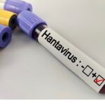 Hantavirüs Bir Salgına Dönüşür mü?